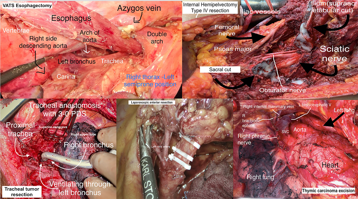 kmc manipal surgical oncology